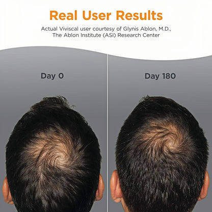 Viviscal Men's Hair Growth Supplements for Thicker FullerHair, Clinically Proven Collagen Complex, 180 Tablets 3Month Supply